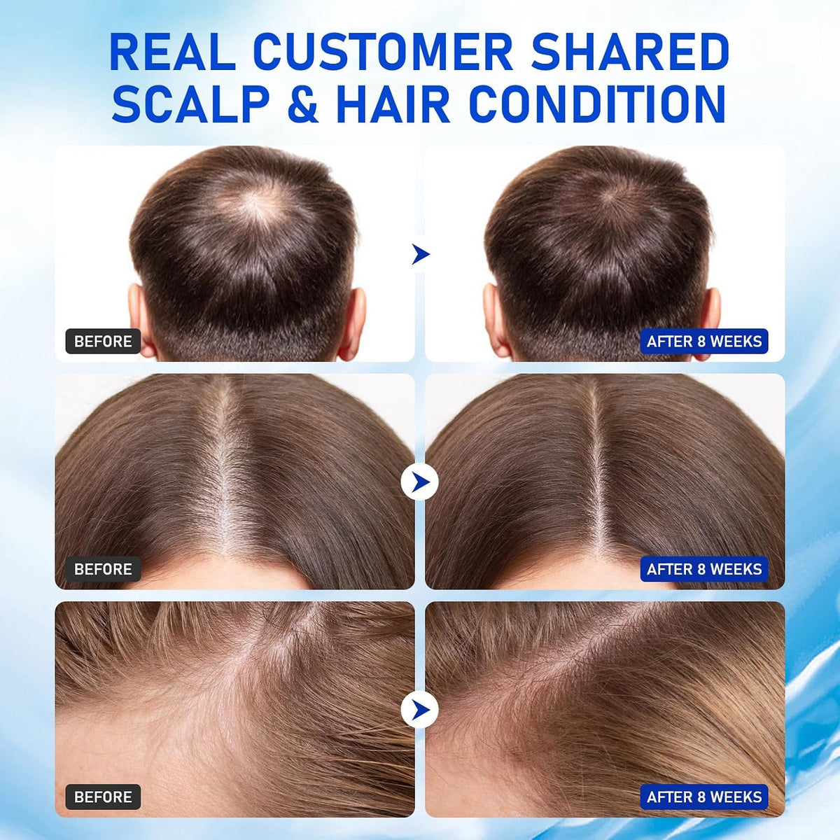 GHK-Cu Copper Peptide Hair & Scalp Serum for Thicker, Fuller-Looking Hair
